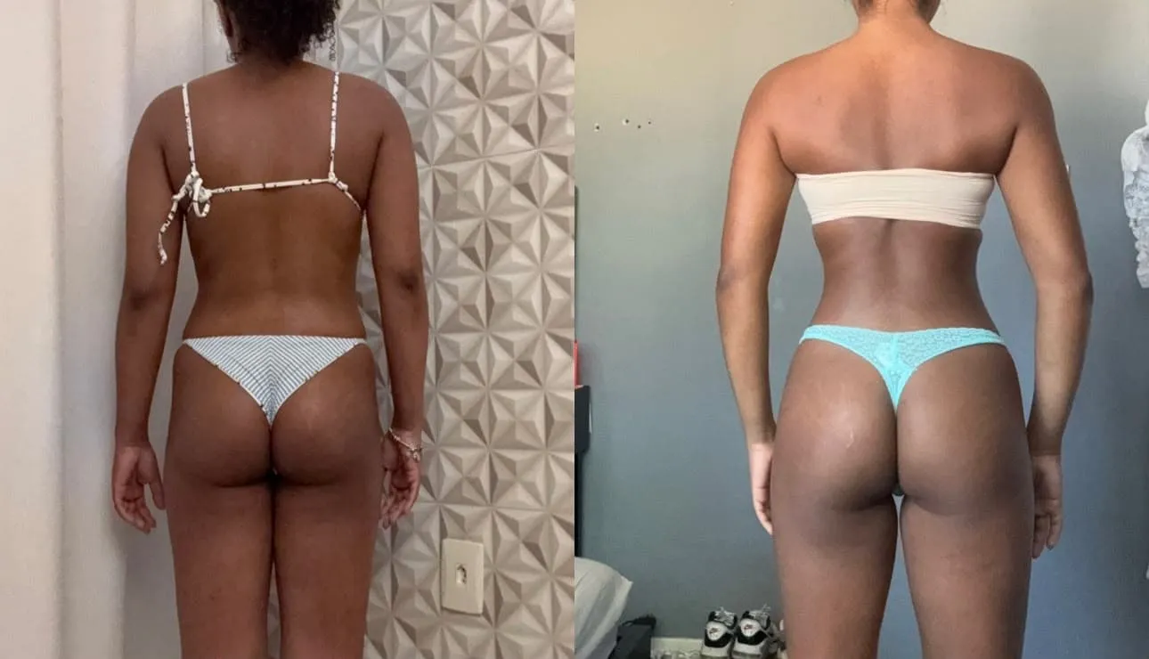 Antes e Depois 4